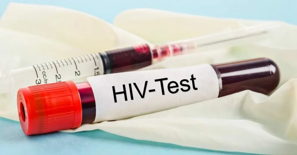 Спид е. Тест на ВИЧ. СПИД. Кровь на тесте на ВИЧ. ВИЧ положительный результат пробирка.