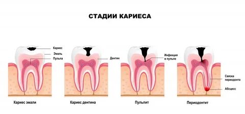 Лечение на разных стадиях