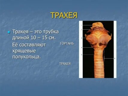 Хрящевые полукольца гортани