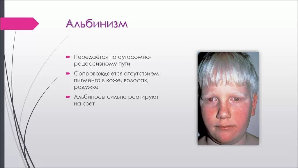 Альбинизм тип наследования. Альбинизм наследственное заболевание. Альбинизм тип наследования аутосомно. Альбинизм схема наследования. Генетическое заболевание альбинизм.