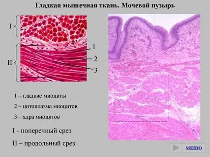 Какую ткань стенки