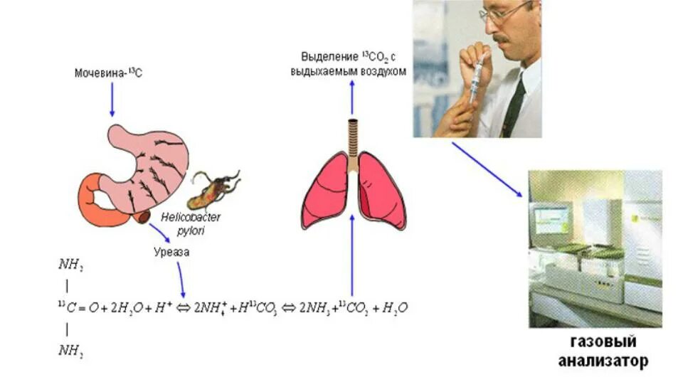 13с-уреазный дыхательный тест на Helicobacter pylori. Дыхательный уреазный тест с мочевиной с13. 13с-уреазный дыхательный тест заключение. С13 дыхательный тест на хеликобактер.