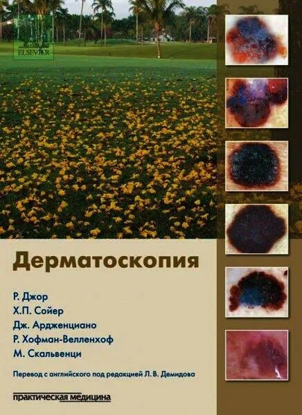 дерматоскопия джонатан боулинг. диагностическая дерматоскопия джонатан. боулинг дерматоскопия. атлас по дерматоскопии под редакцией потекаева. диагностическая дерматоскопия боулинг.