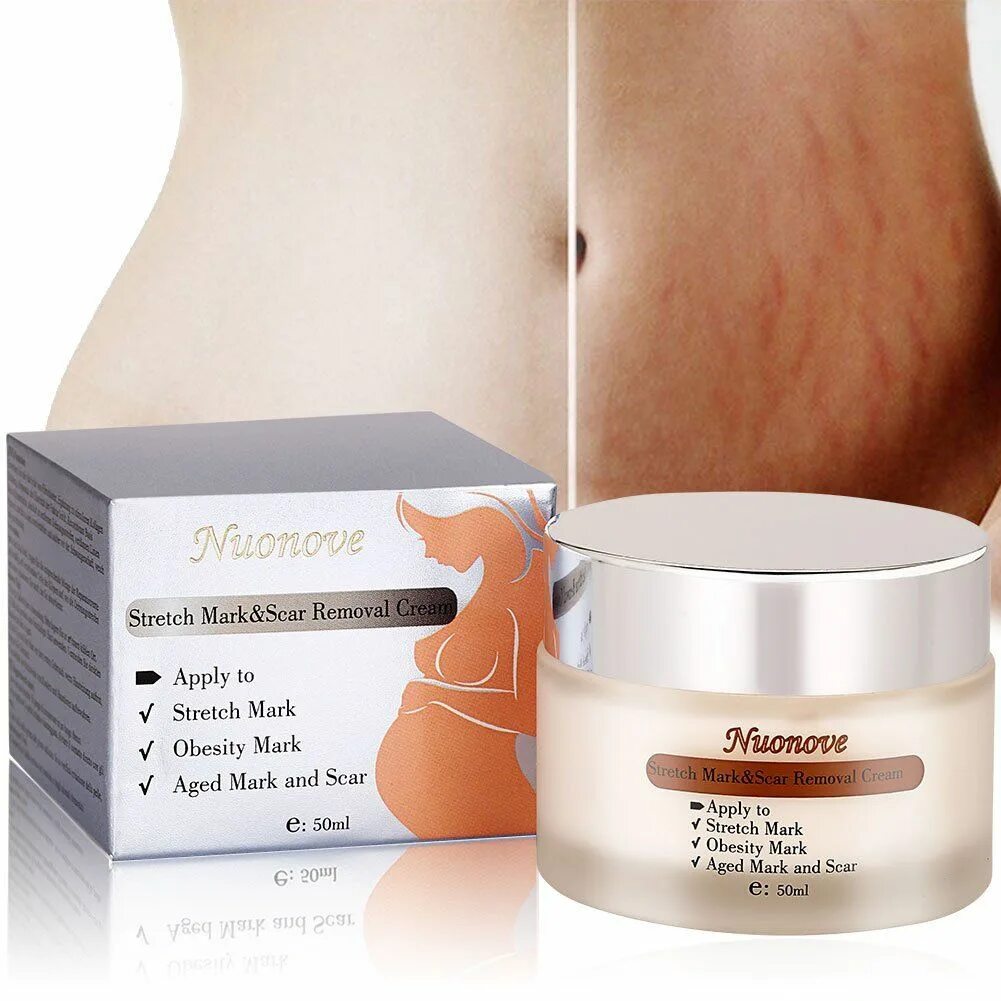 Stretch mark cream. Стретч Маркс крем. Stretch Marks крем от растяжек.