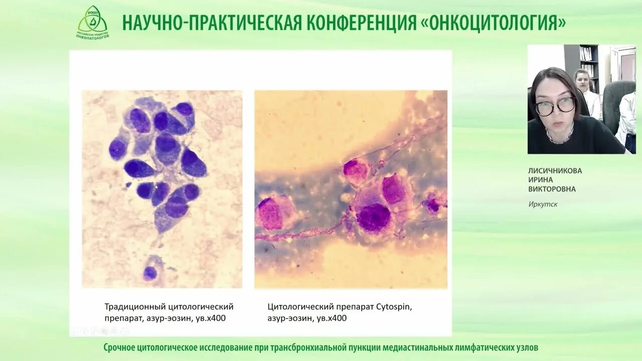 Цитологическое исследование пунктата. Цитологическое исследование лимфоузлов. Цитология лимфоузла цитологическое. Цитология по Лейшману. Цитологическое исследование промывных вод бронхов.