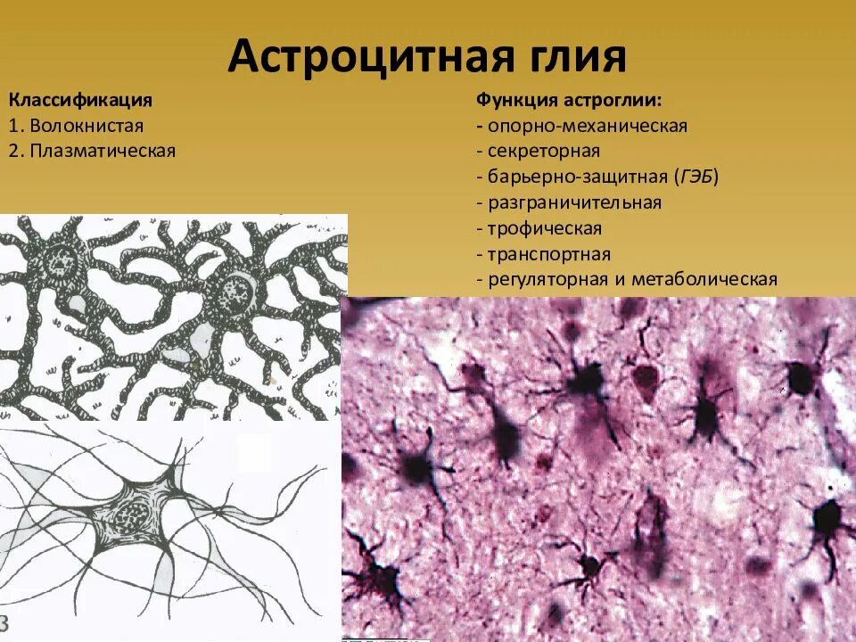 Строение нейроглии гистология. Нервная ткань классификация глии. Астроцитная глия препарат гистология. Волокнистые астроциты гистология.