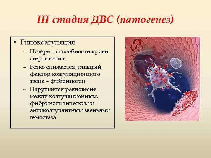 Iii стадия. Iii стадия