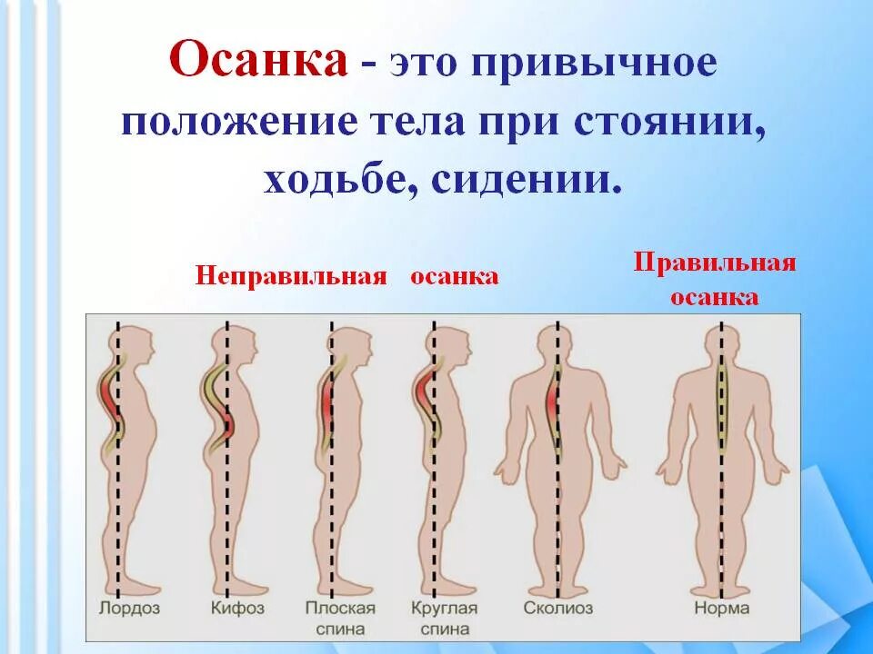 Прямая поясница. Осанка. Правильная осанка. Дефекты осанки. Правильная и неправильная осанка.