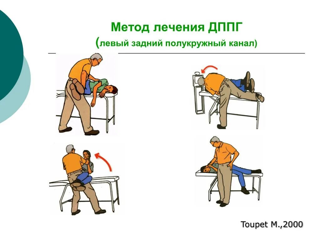 Доброкачественное позиционное головокружение лечение. Дппг доброкачественное пароксизмальное позиционное головокружение. дппг заднего полукружного канала. дппг упражнения. дппг брандта дароффа.