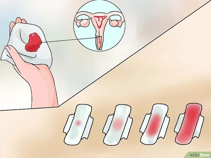 Либидо во время месячных. Менструальное кровотечение. Обильные менструальные кровотечения. Кровотечение менструационного цикла. Имплантационное кровотечение.