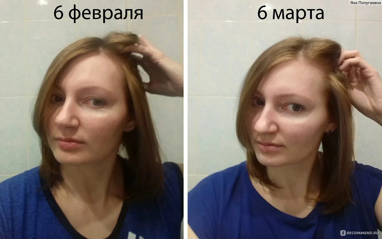 Луковая маска для волос до и после. Маска для волос до и после. Волосы после луковой маски до и после. Луковая маска для волос фото до и после. Луков маска для волос отзывы