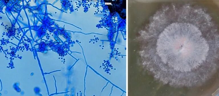 Микроскопия trichophyton rubrum. Трихофитон ментагрофитес микроскопия. Поверхностная трихофития микроскопия. Грибок трихофитон рубрум. Гриб трихофитон.