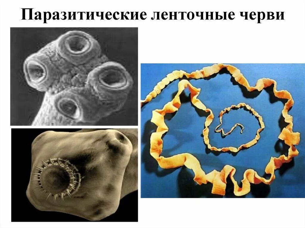 Жизнь ленточного червя. Паразитические ленточные черви. Паразитический ленточный червь. Среда обитания ленточных червей. Класс ленточные черви среда обитания.