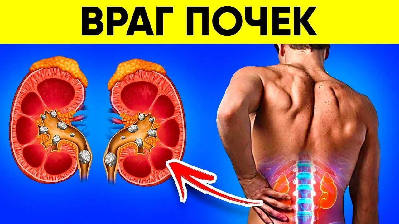 диета полезная для почек. продукты полезные для почек. лучшие продукты для почек. вред для почек. вред для почек.