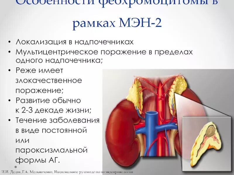 Синдром множественной эндокринной неоплазии. Множественная эндокринная неоплазия 2 типа. Множественная эндокринная неоплазия (Мэн) 2 типа. Синдром множественной эндокринной неоплазии 1. Множественная локализация