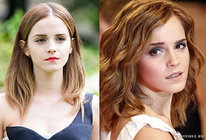 шейлин вудли до стрижки и после. длинные или короткие волосы. какие волосы лучше длинные или короткие. энн хэтэуэй с длинными волосами. эмма уотсон пластика носа.