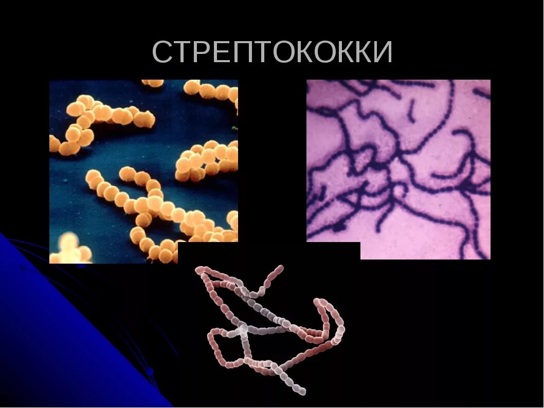 Стрептококковые бактерии