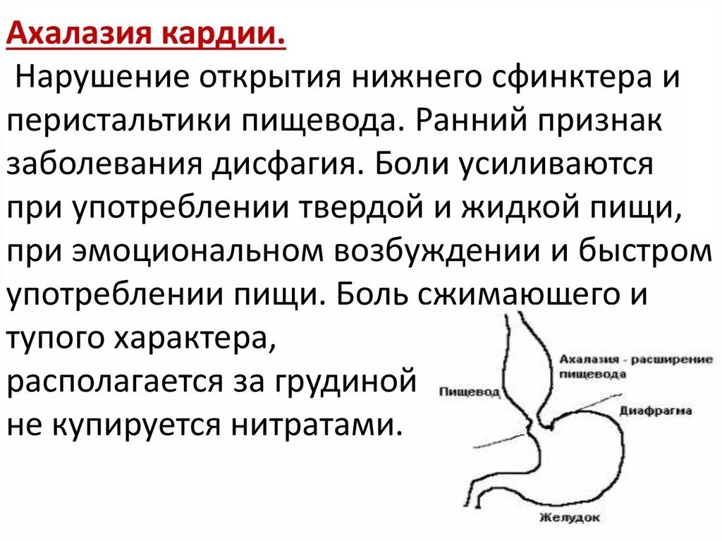 Гипотония желудка. Недостаточность кардиального отдела пищевода. Кардиальный сфинктер недостаточность. Халазия кардии пищевода. Кардиальный сфинктер пищевода.