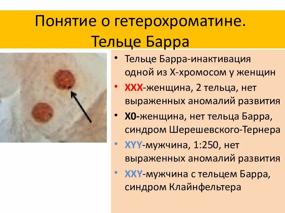 Тельце Барра в клетках буккального эпителия. Тельца Барра. Половой хроматин тельца Барра. Тельца Барра это в генетике.