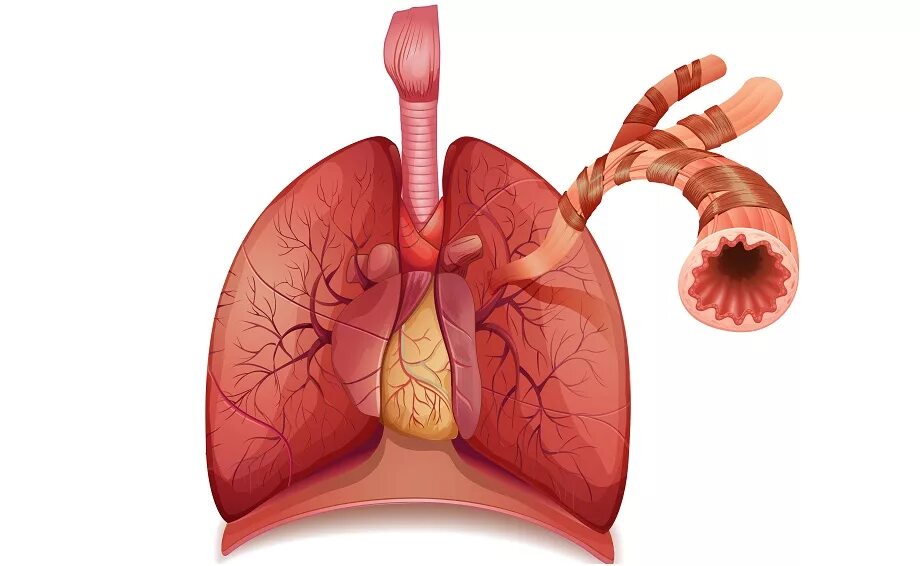 Бронхит сердца. Бронхи. Бронхи и легкие.