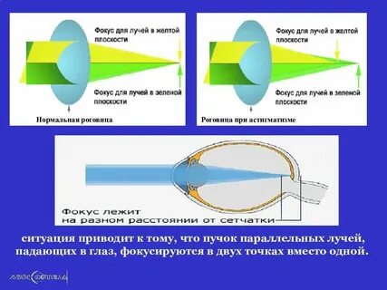 Транспозиция в оптике