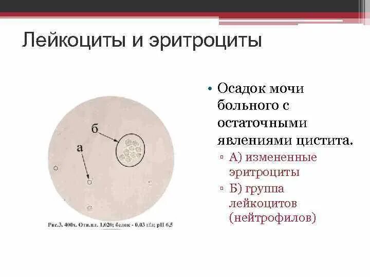 Сколько эритроцитов в моче