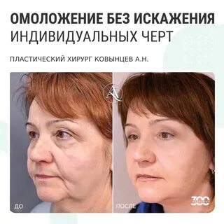 Смас веки