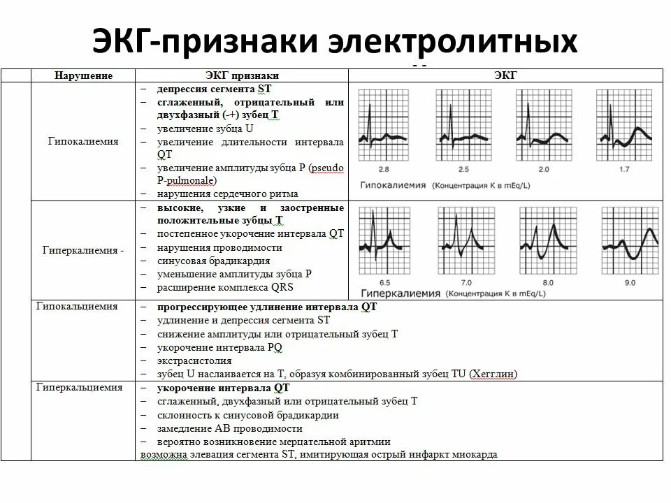 Экг метаболические изменения что это значит. ЭКГ патологии расшифровка. Зубец т на ЭКГ норма и патология. ЭКГ патологии расшифровка таблица. Электролитные нарушения на ЭКГ признаки.