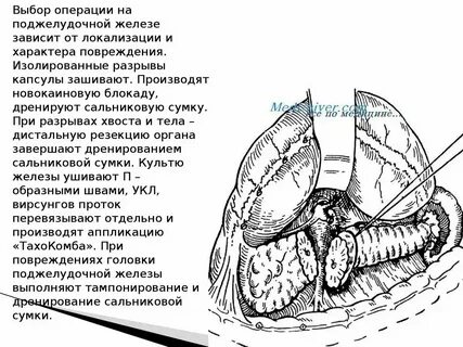 Повреждение органа 6
