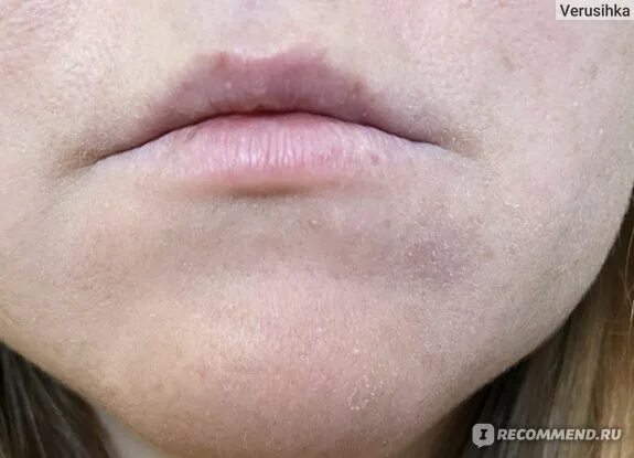 Тоналка шелушится. Тональный крем подчеркивает шелушения. Тональный крем для лица. Тональный крем подчеркивает шелушения. Тональный крем на шелушащуюся кожу.