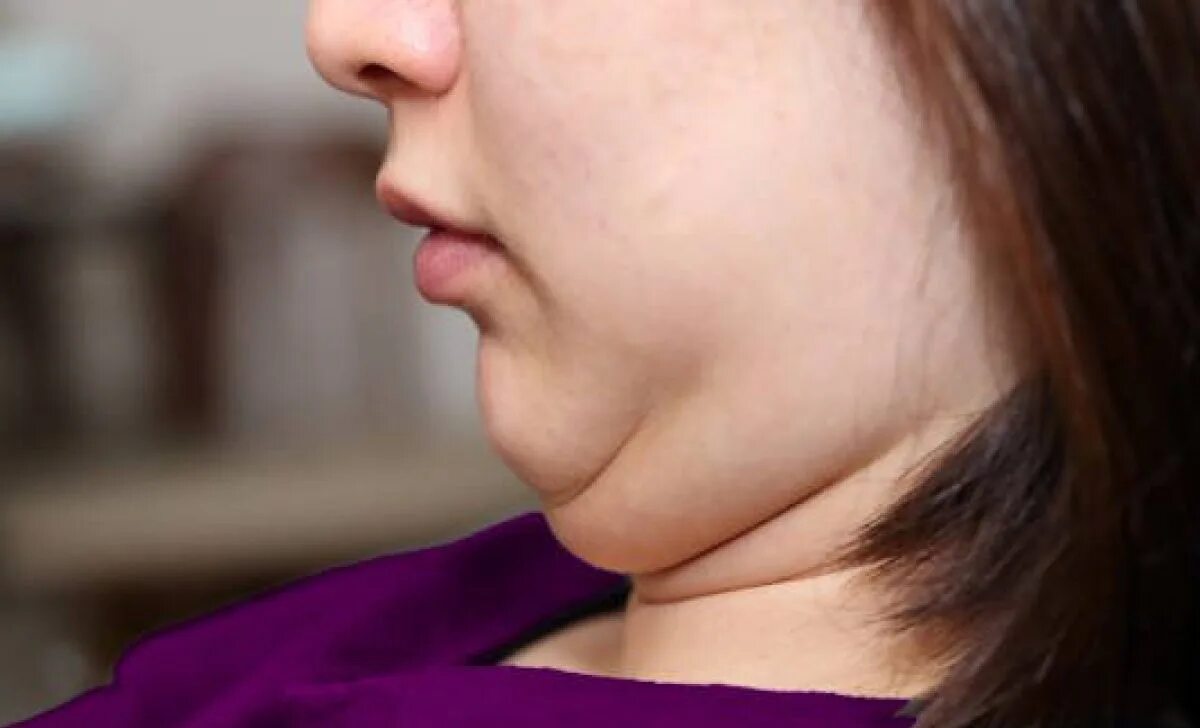 Подбородок у ребенка на шее. Второй подбородок фото у женщин. Подбородок у ребенка на шее. Пятна на подбородке у ребенка. Губы сбоку.