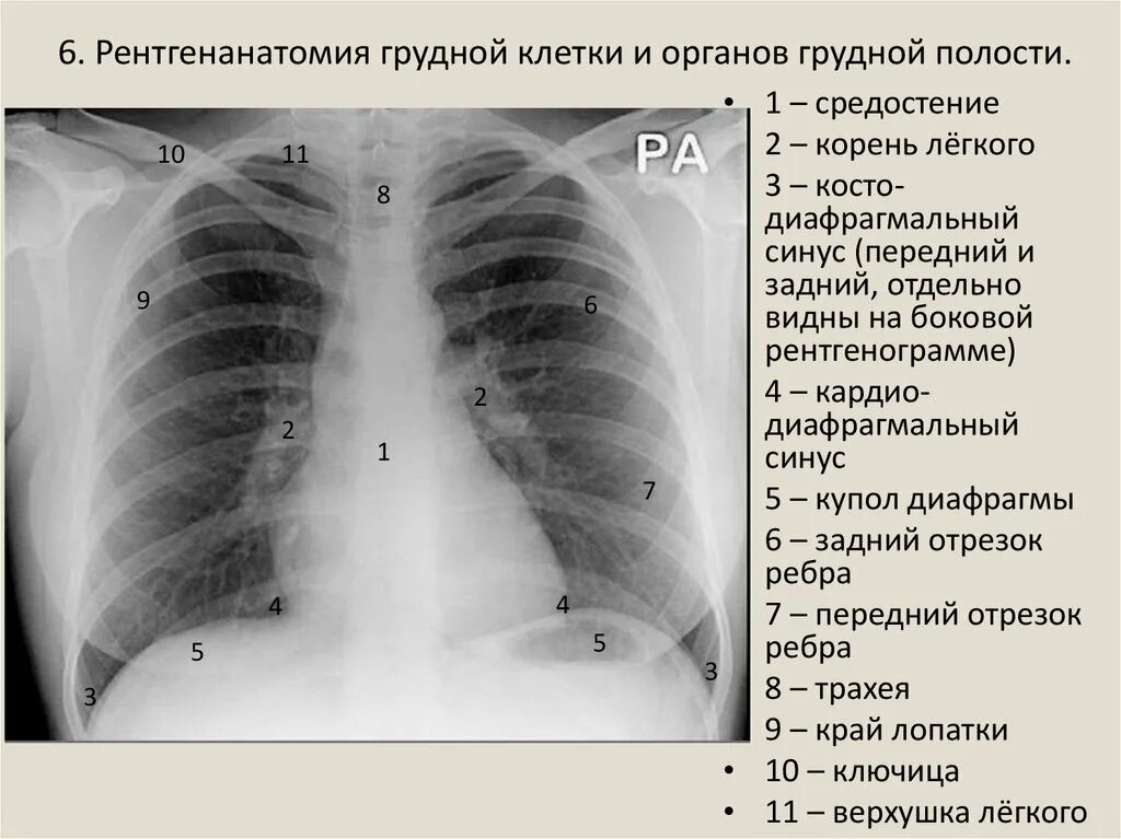 Какие легкие в норме. Передняя проекция грудной клетки рентген. Рентгеноанатомия органов грудной клетки. Рентген грудной клетки в боковой проекции норма.