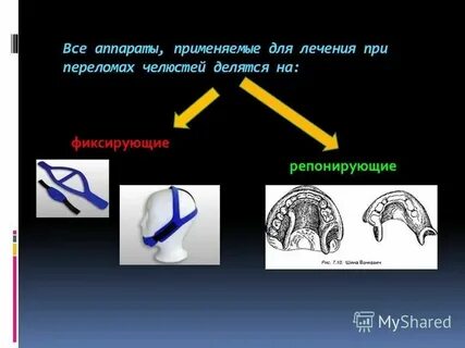 Ортопедическое лечение челюстно лицевых больных