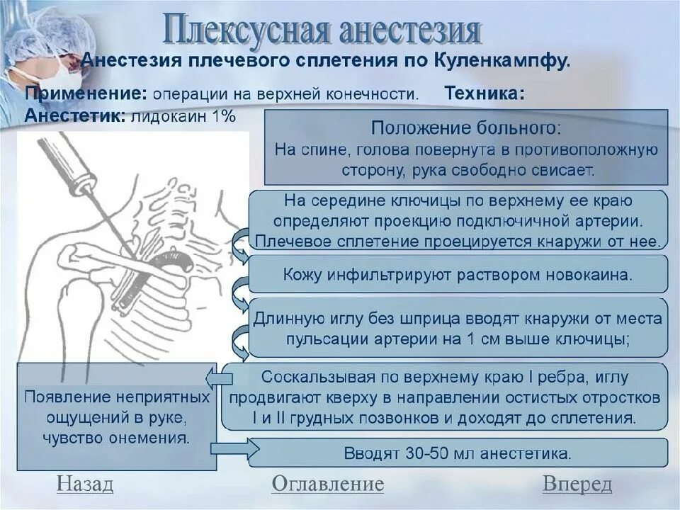 Выполнение блокад. Блокада плечевого нервного сплетения по куленкампфу. блокада плечевого сплетения по куленкампфу техника. анестезия плечевого сплетения по куленкампфу. проводниковая и плексусная анестезия.