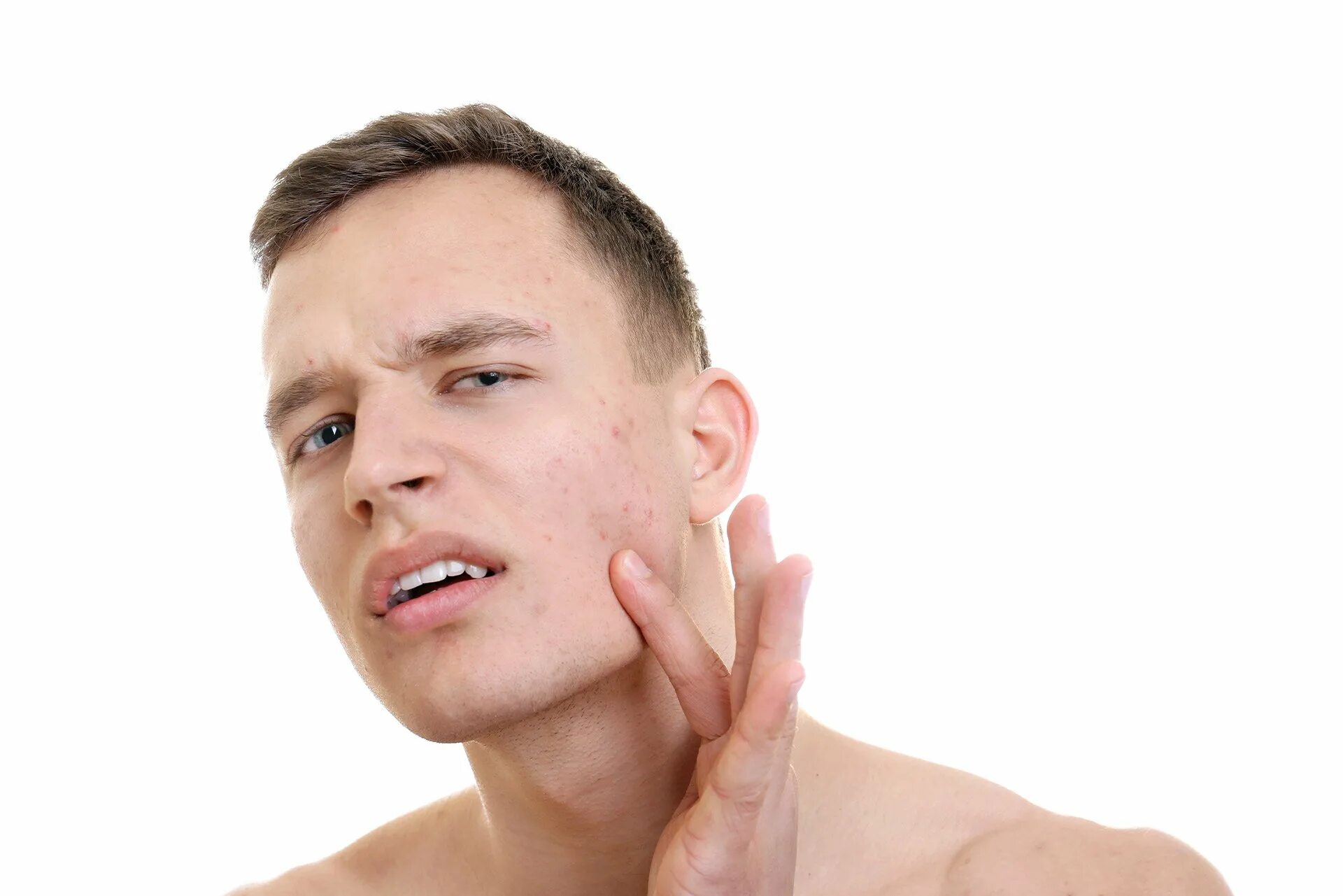 Face this problem. Face this problem. Face this problem. Девушка с проблемной кожей. Face this problem.