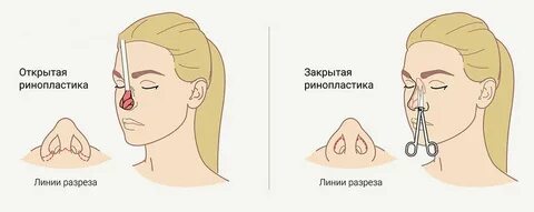 Как открыть нос