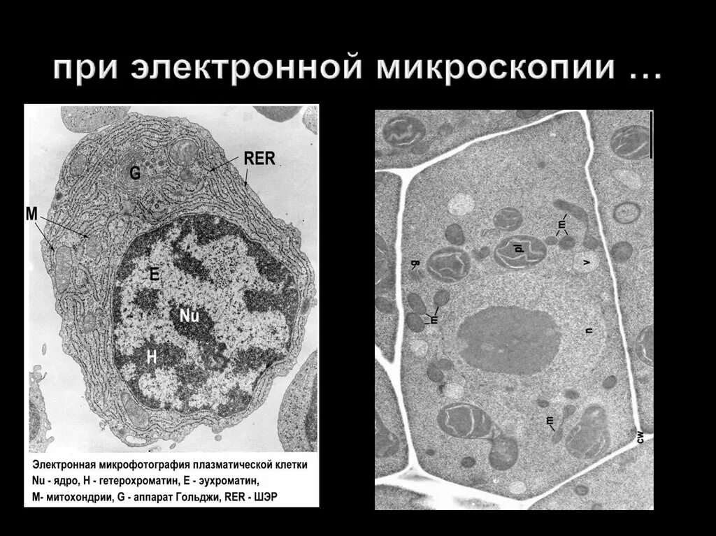 Какой тип микроскопии использовался для получения микрофотографии