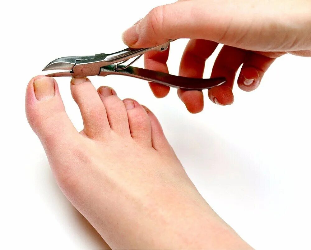 Правильная стрижка ногтей на ногах. Подстригание ногтей на ногах. Как подстригать ногти на большом пальце