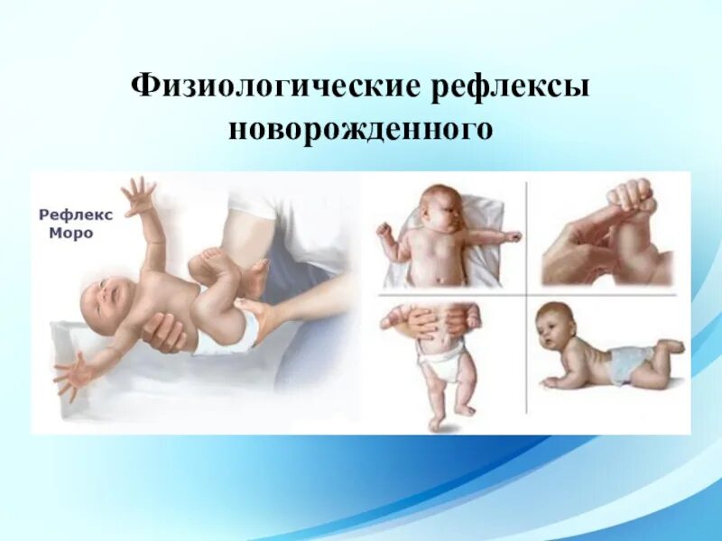 Врожденные рефлексы организма. Безусловные рефлексы новорожденного таблица. Физиологические рефлексы новорожденного. Врожденные рефлексы новорожденных. Врожденные безусловные рефлексы новорожденного.