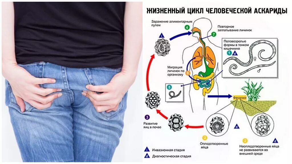 Жизненный цикл Ascaris lumbricoides схема. Цикл развития аскариды человека схема. Жизненный цикл аскариды человеческой схема.