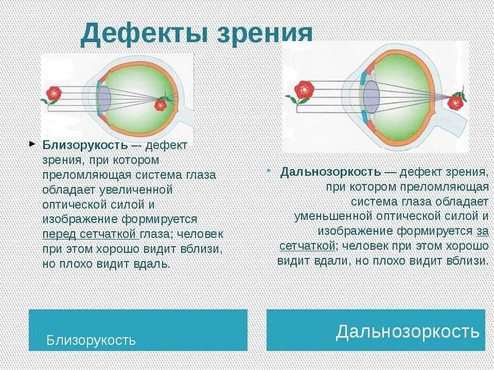 Дальнозоркость и близорукость строение глаза. Близорукость и дальнозоркость схема физика. Оптическая система глаза физика близорукость дальнозоркость. Близорукость и дальнозоркость с точки зрения физики. Какое зрение при дальнозоркости