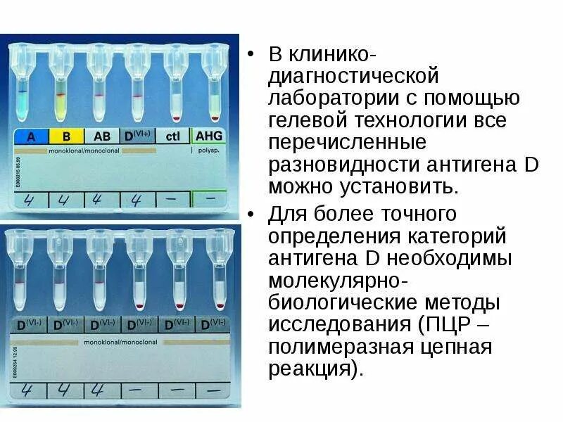 Антитела в иммуногематологии тест нмо. Антитела в иммуногематологии тест нмо