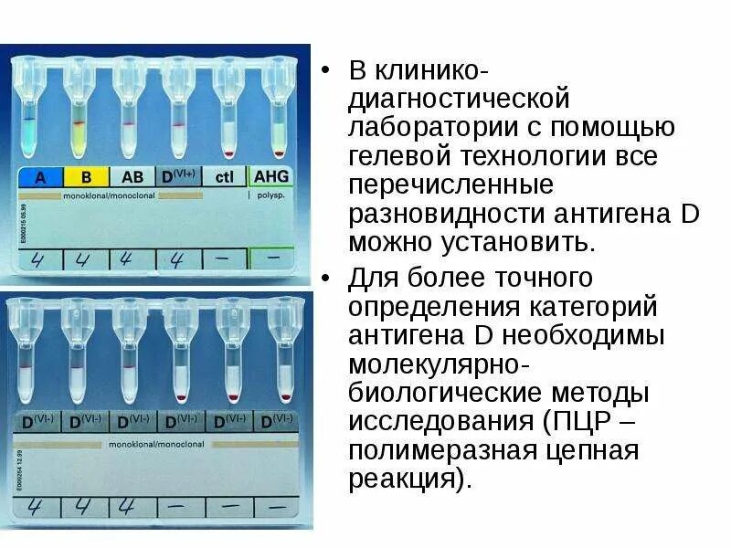 Антиген кдл. Определение группы крови гелевым методом. Гелевый метод определения группы крови. Гелевая методика определения групп крови. Гелевые технологии определения группы крови.