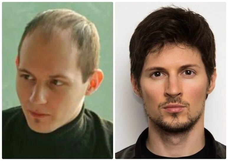 Павел Дуров: как выглядел создатель Вконтакте до того, как стал миллиардером и п