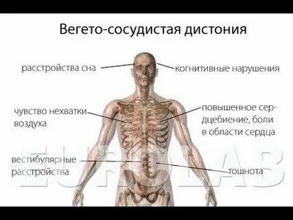 Дистония головного мозга