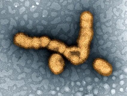 H 1 n 1