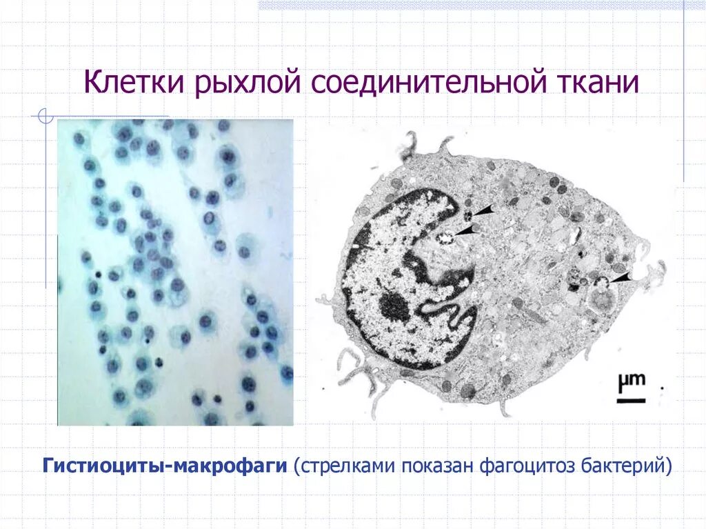 Гистиоциты соединительной ткани. Макрофаги клетки гистиоциты. Клетки фагоциты рыхлосоединительной ткани. Гистиоциты в рыхлой соединительной ткани. Макрофаги в тканях