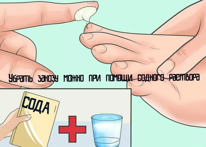 Как достать занозу у ребенка. Как вытащить занозу у ребенка. как вытащить занозу с пальца. как быстро достать занозу.