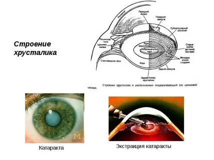 Связка хрусталика глаза функции
