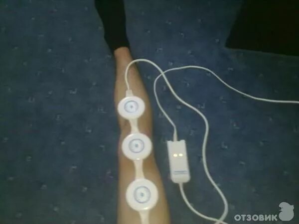 алмаг при варикозе. алмаг 01 на голеностопный сустав. алмаг при варикозе. алмаг-01 наложение. алмаг 01 для коленного сустава.